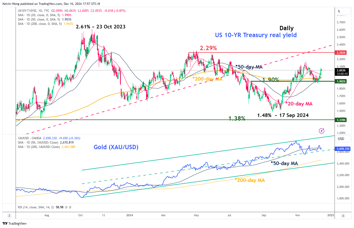 US10Y-T10YIE-Daily Chart